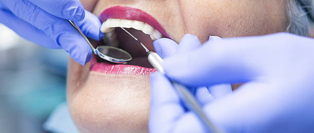 Best Emergency Dental Care for Broken or Chipped Teeth in West Clarkston Highland, WA
